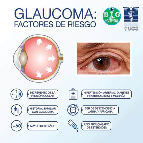 img glucoma 2