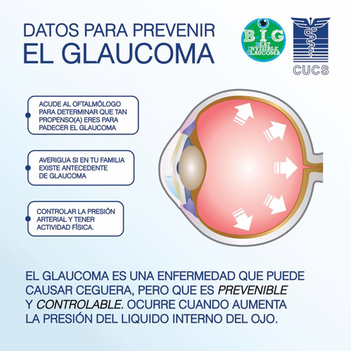 img glucoma 3