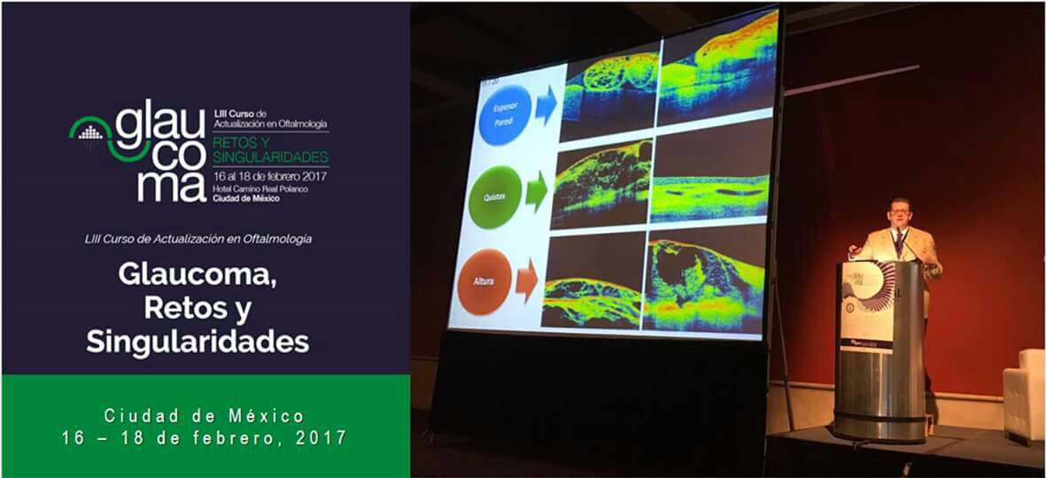 “Glaucoma, Retos y Singularidades”